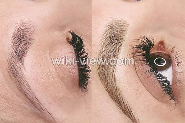 تقویت ابرو, تقویت ابرو با سیر, گردوی سوخته برای تقویت ابرو, تقویت ابرو با بادام سوخته, تقویت ابرو با قرص ال دی, روغن تقویت ابرو و مژه, تقویت ابرو در طب سنتی, بهترین روغن ها برای تقویت ابرو تقویت ابرو, تقویت ابرو با سیر, گردوی سوخته برای تقویت ابرو, تقویت ابرو با بادام سوخته, تقویت ابرو با قرص ال دی, روغن تقویت ابرو و مژه, تقویت ابرو در طب سنتی, بهترین روغن ها برای تقویت ابرو