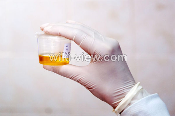 عفونت مثانه, علائم عفونت مثانه چیست, درمان عفونت مثانه, درمان عفونت مثانه در طب سنتی, آنتی بیوتیک برای عفونت مثانه, عفونت مثانه در مردان, نام قرص عفونت ادراری, درد مثانه, انتی بیوتیک قوی برای عفونت ادراری عفونت مثانه, علائم عفونت مثانه چیست, درمان عفونت مثانه, درمان عفونت مثانه در طب سنتی, آنتی بیوتیک برای عفونت مثانه, عفونت مثانه در مردان, نام قرص عفونت ادراری, درد مثانه, انتی بیوتیک قوی برای عفونت ادراری