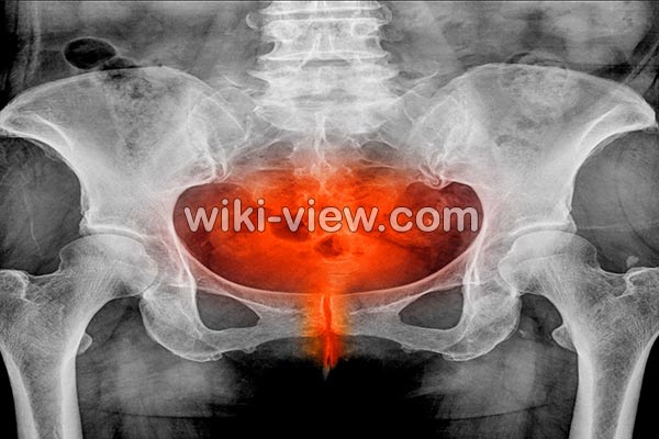 عفونت مثانه, علائم عفونت مثانه چیست, درمان عفونت مثانه, درمان عفونت مثانه در طب سنتی, آنتی بیوتیک برای عفونت مثانه, عفونت مثانه در مردان, نام قرص عفونت ادراری, درد مثانه, انتی بیوتیک قوی برای عفونت ادراری عفونت مثانه, علائم عفونت مثانه چیست, درمان عفونت مثانه, درمان عفونت مثانه در طب سنتی, آنتی بیوتیک برای عفونت مثانه, عفونت مثانه در مردان, نام قرص عفونت ادراری, درد مثانه, انتی بیوتیک قوی برای عفونت ادراری
