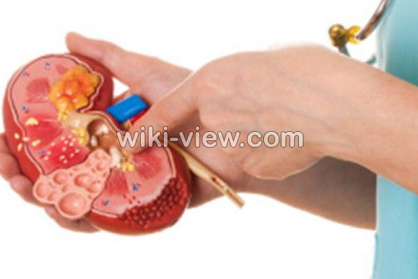 عفونت مثانه, علائم عفونت مثانه چیست, درمان عفونت مثانه, درمان عفونت مثانه در طب سنتی, آنتی بیوتیک برای عفونت مثانه, عفونت مثانه در مردان, نام قرص عفونت ادراری, درد مثانه, انتی بیوتیک قوی برای عفونت ادراری عفونت مثانه, علائم عفونت مثانه چیست, درمان عفونت مثانه, درمان عفونت مثانه در طب سنتی, آنتی بیوتیک برای عفونت مثانه, عفونت مثانه در مردان, نام قرص عفونت ادراری, درد مثانه, انتی بیوتیک قوی برای عفونت ادراری