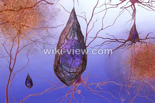 آلزایمر, علائم آلزایمر, علت آلزایمر, جدیدترین داروی آلزایمر, درمان آلزایمر در طب سنتی, پیشگیری از آلزایمر, آلزایمر در سالمندان, تست تشخیص آلزایمر, مرگ بیماران آلزایمری, علائم آلزایمر در جوانی, مراحل اخر الزایمر آلزایمر, علائم آلزایمر, علت آلزایمر, جدیدترین داروی آلزایمر, درمان آلزایمر در طب سنتی, پیشگیری از آلزایمر, آلزایمر در سالمندان, تست تشخیص آلزایمر, مرگ بیماران آلزایمری, علائم آلزایمر در جوانی, مراحل اخر الزایمر