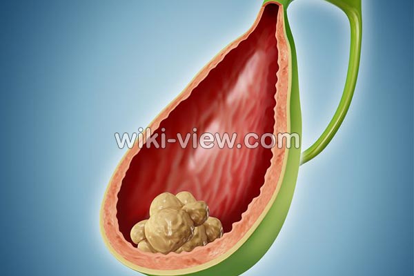 کیسه صفرا, کیسه صفرا چیست, کار کیسه صفرا, علائم کیسه صفرا, عفونت کیسه صفرا, کیسه صفرا و بیماریهای آن, عمل کیسه صفرا, عوارض برداشتن کیسه صفرا کیسه صفرا, کیسه صفرا چیست, کار کیسه صفرا, علائم کیسه صفرا, عفونت کیسه صفرا, کیسه صفرا و بیماریهای آن, عمل کیسه صفرا, عوارض برداشتن کیسه صفرا