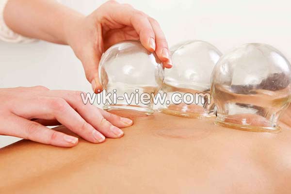 حجامت, حجامت چیست, حجامت فواید, ضرر حجامت, خطرات حجامت, روش حجامت, زمان حجامت, حجامت عام, حجامت کبد, حجامت سر, تقویم حجامت ۹۸, تقویم حجامت 99 حجامت, حجامت چیست, حجامت فواید, ضرر حجامت, خطرات حجامت, روش حجامت, زمان حجامت, حجامت عام, حجامت کبد, حجامت سر, تقویم حجامت ۹۸, تقویم حجامت 99
