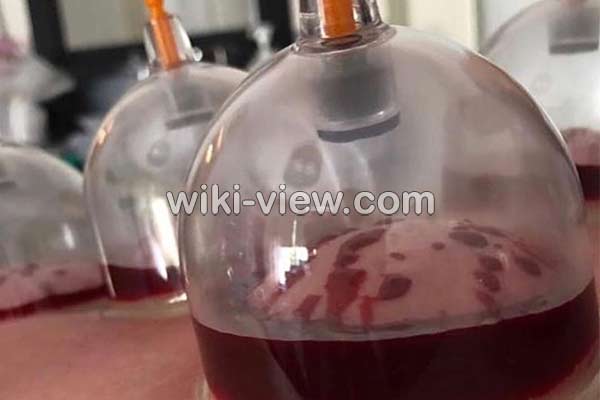 حجامت, حجامت چیست, حجامت فواید, ضرر حجامت, خطرات حجامت, روش حجامت, زمان حجامت, حجامت عام, حجامت کبد, حجامت سر, تقویم حجامت ۹۸, تقویم حجامت 99 حجامت, حجامت چیست, حجامت فواید, ضرر حجامت, خطرات حجامت, روش حجامت, زمان حجامت, حجامت عام, حجامت کبد, حجامت سر, تقویم حجامت ۹۸, تقویم حجامت 99