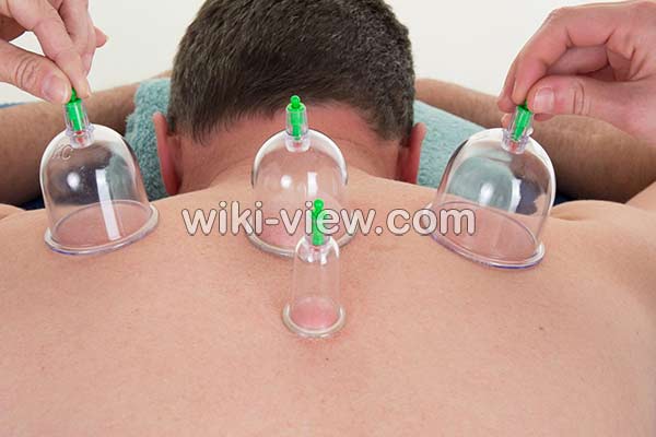 حجامت, حجامت چیست, حجامت فواید, ضرر حجامت, خطرات حجامت, روش حجامت, زمان حجامت, حجامت عام, حجامت کبد, حجامت سر, تقویم حجامت ۹۸, تقویم حجامت 99 حجامت, حجامت چیست, حجامت فواید, ضرر حجامت, خطرات حجامت, روش حجامت, زمان حجامت, حجامت عام, حجامت کبد, حجامت سر, تقویم حجامت ۹۸, تقویم حجامت 99