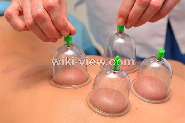 حجامت, حجامت چیست, حجامت فواید, ضرر حجامت, خطرات حجامت, روش حجامت, زمان حجامت, حجامت عام, حجامت کبد, حجامت سر, تقویم حجامت ۹۸, تقویم حجامت 99 حجامت, حجامت چیست, حجامت فواید, ضرر حجامت, خطرات حجامت, روش حجامت, زمان حجامت, حجامت عام, حجامت کبد, حجامت سر, تقویم حجامت ۹۸, تقویم حجامت 99