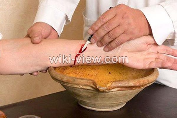 فصد, فصد چیست, فواید فصد, عوارض فصد خون چیست, فواید فصد دست چپ, فواید فصد دست راست, فصد خون, فواید فصد خون, فصد پا فصد, فصد چیست, فواید فصد, عوارض فصد خون چیست, فواید فصد دست چپ, فواید فصد دست راست, فصد خون, فواید فصد خون, فصد پا